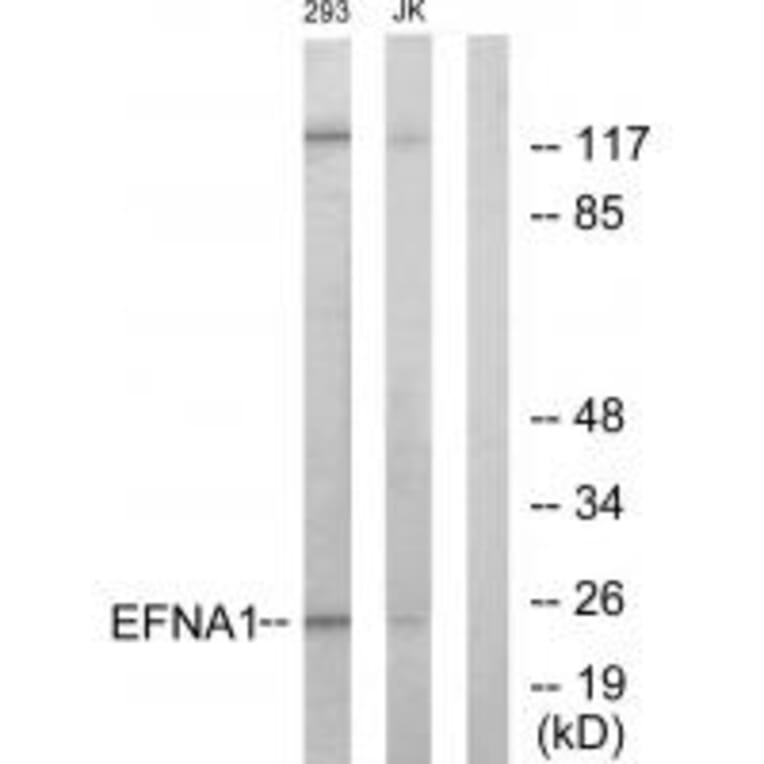 Western blot - EFNA1 Antibody from Signalway Antibody (33711) - Antibodies.com