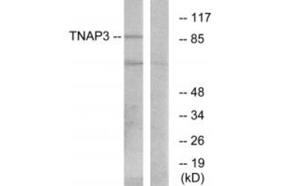 Western blot - TNAP3 Antibody from Signalway Antibody (33714) - Antibodies.com