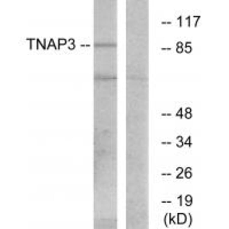 Western blot - TNAP3 Antibody from Signalway Antibody (33714) - Antibodies.com