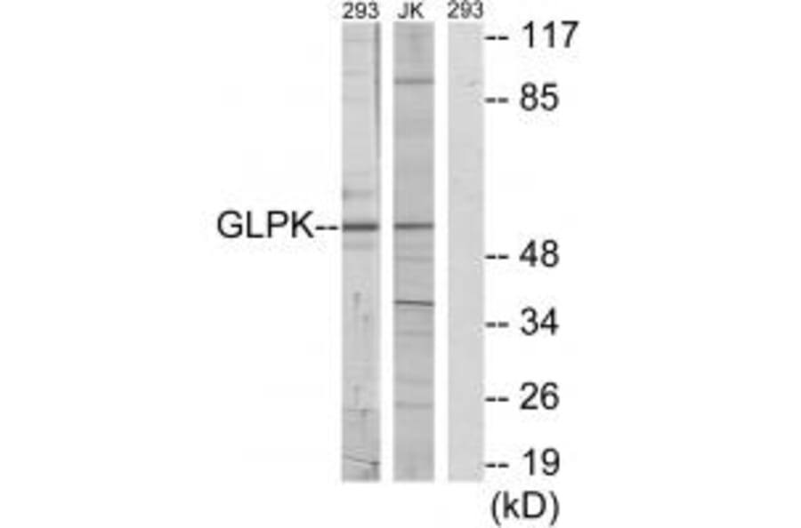 Western blot - GLPK Antibody from Signalway Antibody (33749) - Antibodies.com