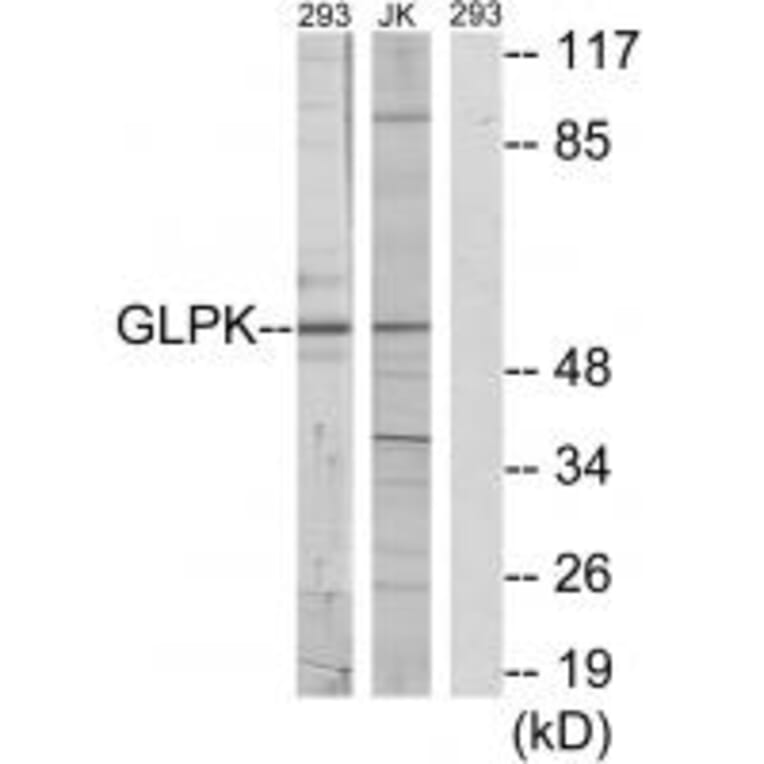 Western blot - GLPK Antibody from Signalway Antibody (33749) - Antibodies.com