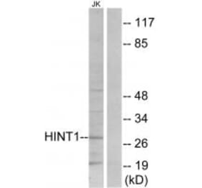 Western blot - HINT1 Antibody from Signalway Antibody (33787) - Antibodies.com
