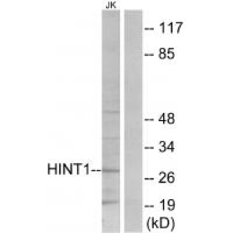 Western blot - HINT1 Antibody from Signalway Antibody (33787) - Antibodies.com