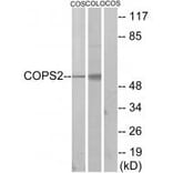 Western blot - COPS2 Antibody from Signalway Antibody (33831) - Antibodies.com