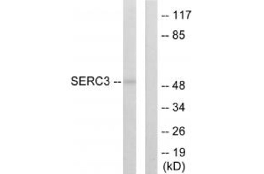 Western blot - SERC3 Antibody from Signalway Antibody (33870) - Antibodies.com