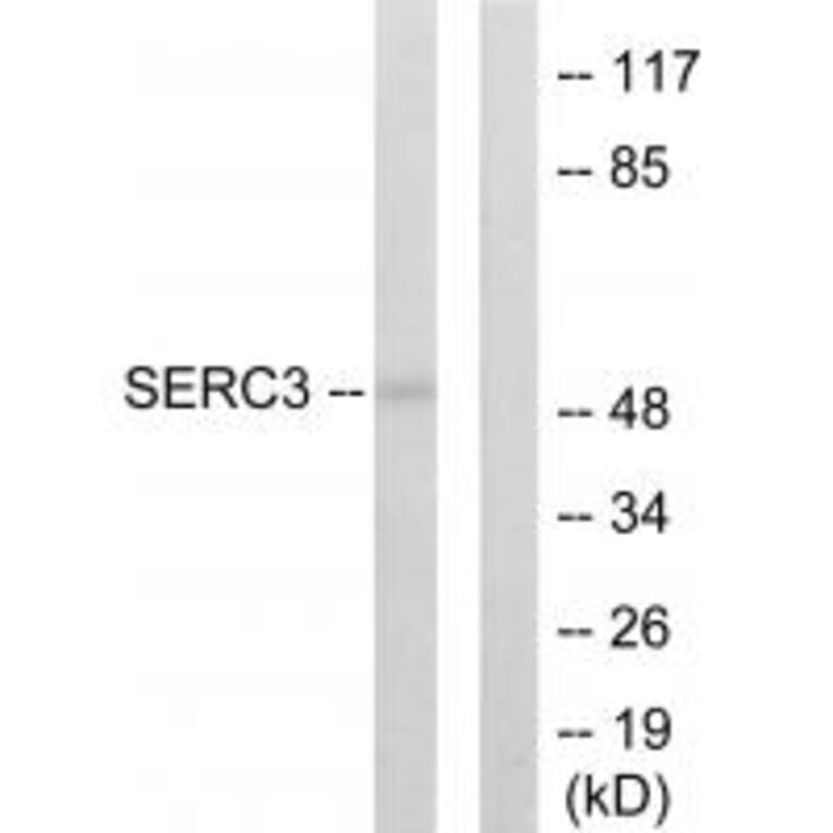 Western blot - SERC3 Antibody from Signalway Antibody (33870) - Antibodies.com