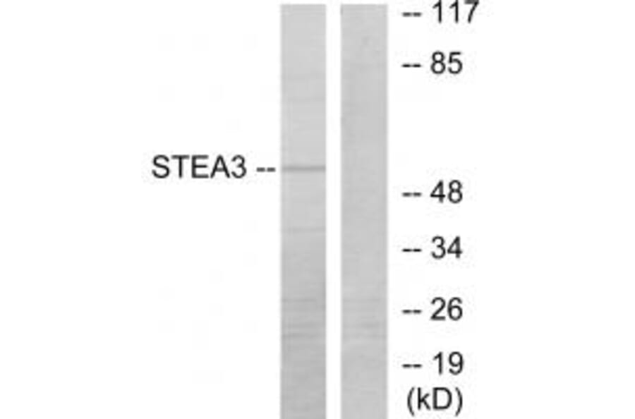 Western blot - STEA3 Antibody from Signalway Antibody (33932) - Antibodies.com