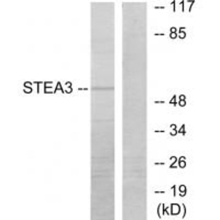 Western blot - STEA3 Antibody from Signalway Antibody (33932) - Antibodies.com