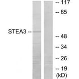 Western blot - STEA3 Antibody from Signalway Antibody (33932) - Antibodies.com