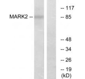 Western blot - MARK2 Antibody from Signalway Antibody (33942) - Antibodies.com
