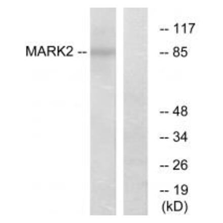 Western blot - MARK2 Antibody from Signalway Antibody (33942) - Antibodies.com