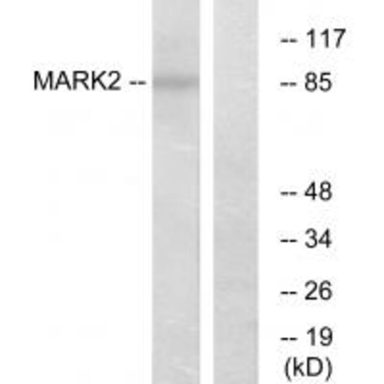 Western blot - MARK2 Antibody from Signalway Antibody (33942) - Antibodies.com