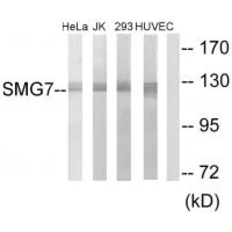 Western blot - SMG7 Antibody from Signalway Antibody (34002) - Antibodies.com