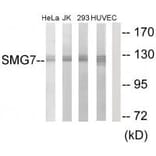 Western blot - SMG7 Antibody from Signalway Antibody (34002) - Antibodies.com