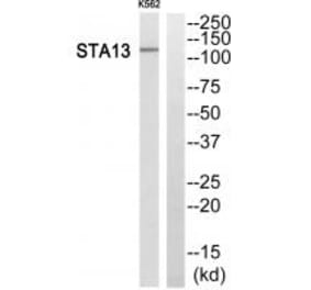 Western blot - STA13 Antibody from Signalway Antibody (34132) - Antibodies.com