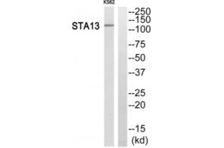 Western blot - STA13 Antibody from Signalway Antibody (34132) - Antibodies.com