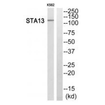 Western blot - STA13 Antibody from Signalway Antibody (34132) - Antibodies.com