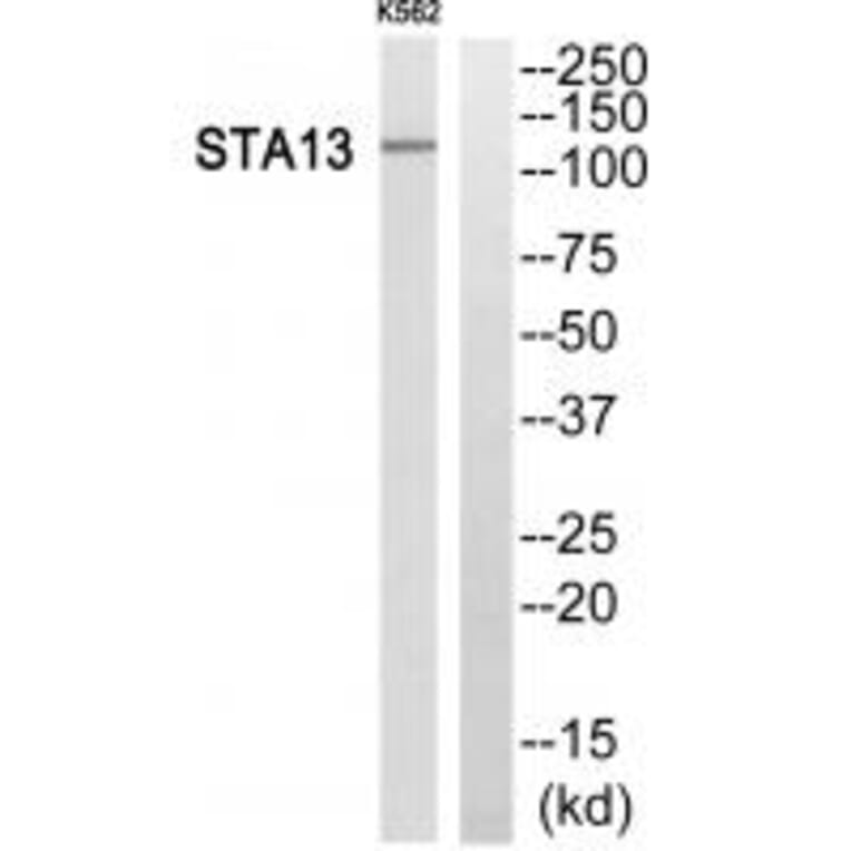 Western blot - STA13 Antibody from Signalway Antibody (34132) - Antibodies.com