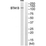 Western blot - STA13 Antibody from Signalway Antibody (34132) - Antibodies.com