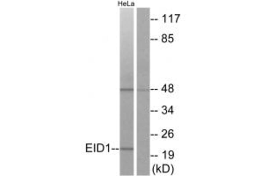 Western blot - EID1 Antibody from Signalway Antibody (34140) - Antibodies.com