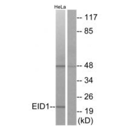 Western blot - EID1 Antibody from Signalway Antibody (34140) - Antibodies.com