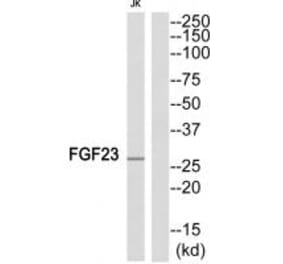 Western blot - FGF23 Antibody from Signalway Antibody (34248) - Antibodies.com