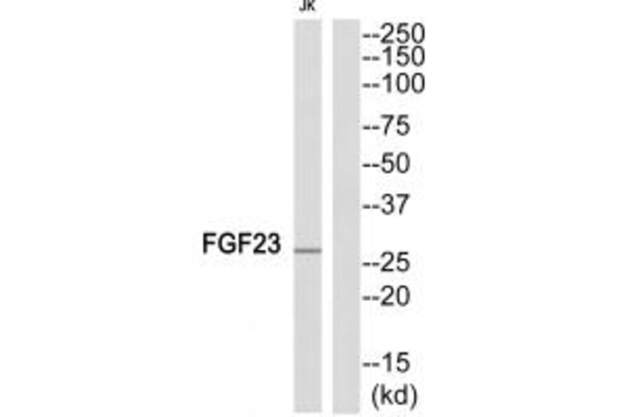 Western blot - FGF23 Antibody from Signalway Antibody (34248) - Antibodies.com