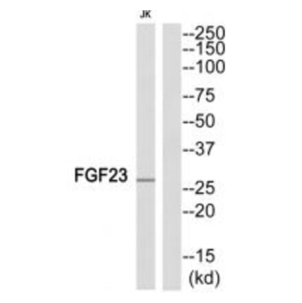 Western blot - FGF23 Antibody from Signalway Antibody (34248) - Antibodies.com
