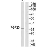 Western blot - FGF23 Antibody from Signalway Antibody (34248) - Antibodies.com