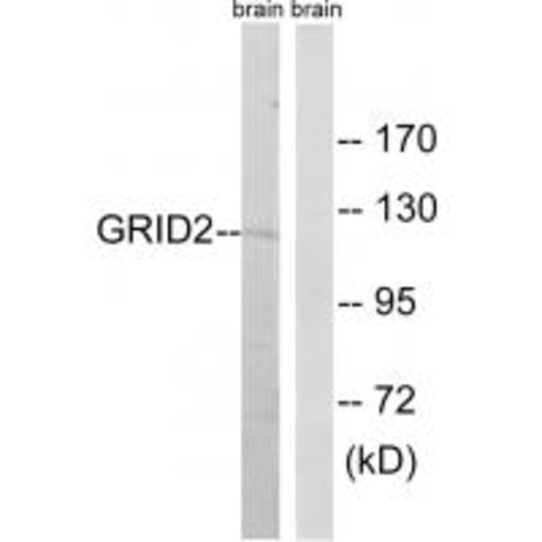 Western blot - GRID2 Antibody from Signalway Antibody (34251) - Antibodies.com