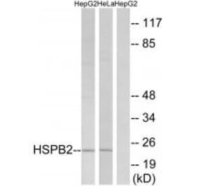 Western blot - HSPB2 Antibody from Signalway Antibody (34252) - Antibodies.com