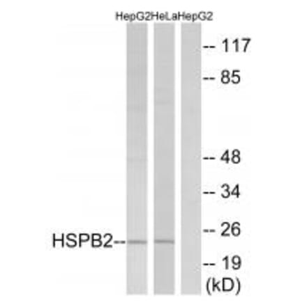 Western blot - HSPB2 Antibody from Signalway Antibody (34252) - Antibodies.com