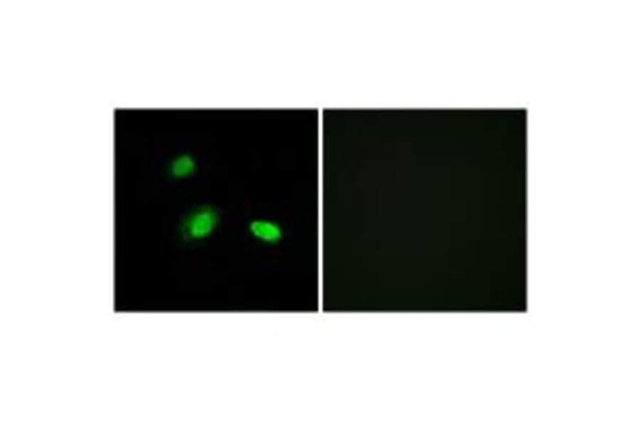 Immunofluorescence - HSPB2 Antibody from Signalway Antibody (34252) - Antibodies.com