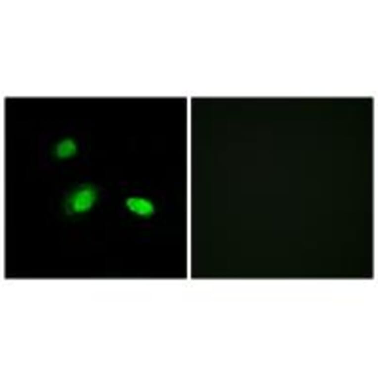 Immunofluorescence - HSPB2 Antibody from Signalway Antibody (34252) - Antibodies.com