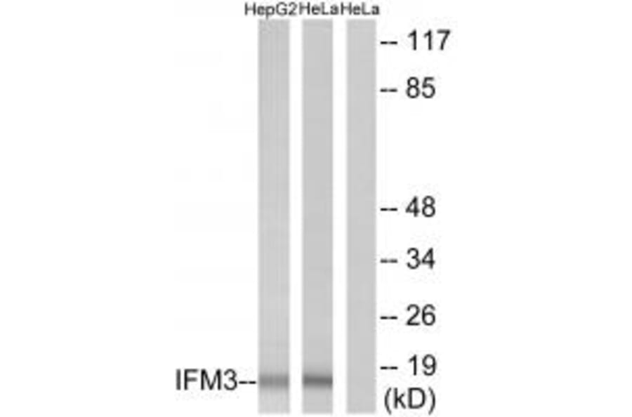 Western blot - IFM3 Antibody from Signalway Antibody (34255) - Antibodies.com