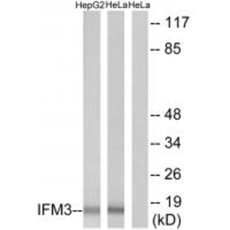 Western blot - IFM3 Antibody from Signalway Antibody (34255) - Antibodies.com