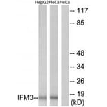 Western blot - IFM3 Antibody from Signalway Antibody (34255) - Antibodies.com