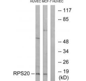 Western blot - RPS20 Antibody from Signalway Antibody (34335) - Antibodies.com