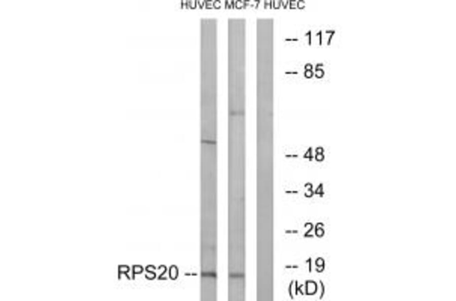 Western blot - RPS20 Antibody from Signalway Antibody (34335) - Antibodies.com