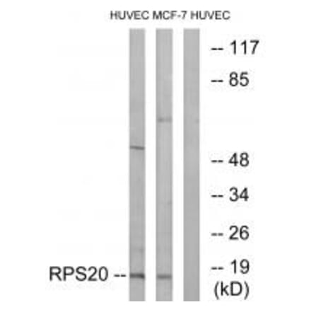 Western blot - RPS20 Antibody from Signalway Antibody (34335) - Antibodies.com