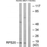 Western blot - RPS20 Antibody from Signalway Antibody (34335) - Antibodies.com