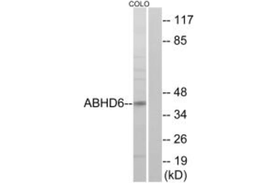 Western blot - ABHD6 Antibody from Signalway Antibody (34371) - Antibodies.com