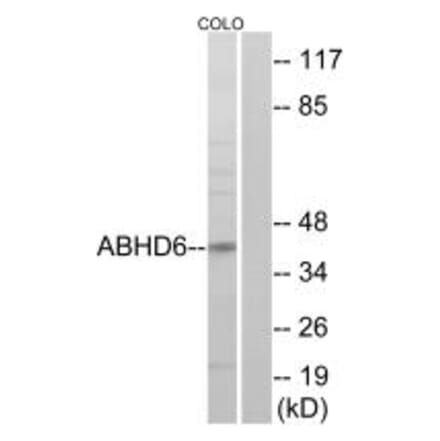 Western blot - ABHD6 Antibody from Signalway Antibody (34371) - Antibodies.com