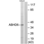 Western blot - ABHD6 Antibody from Signalway Antibody (34371) - Antibodies.com