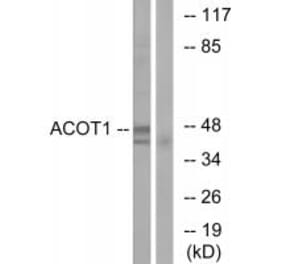 Western blot - ACOT1 Antibody from Signalway Antibody (34379) - Antibodies.com