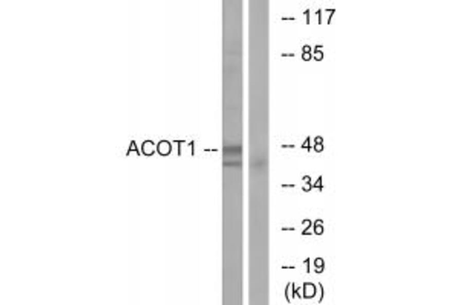 Western blot - ACOT1 Antibody from Signalway Antibody (34379) - Antibodies.com