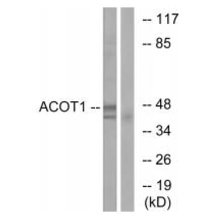 Western blot - ACOT1 Antibody from Signalway Antibody (34379) - Antibodies.com