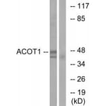 Western blot - ACOT1 Antibody from Signalway Antibody (34379) - Antibodies.com