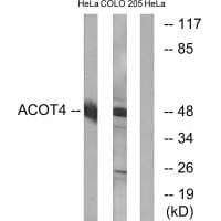 Western blot analysis of extracts from HeLa cells and COLO cells, using ACOT4 antibody #34382.