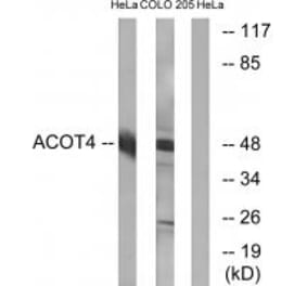 Western blot - ACOT4 Antibody from Signalway Antibody (34382) - Antibodies.com